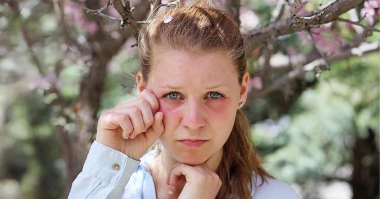 7 Fascinating Reasons Why Food Sensitivities and Allergies Occur