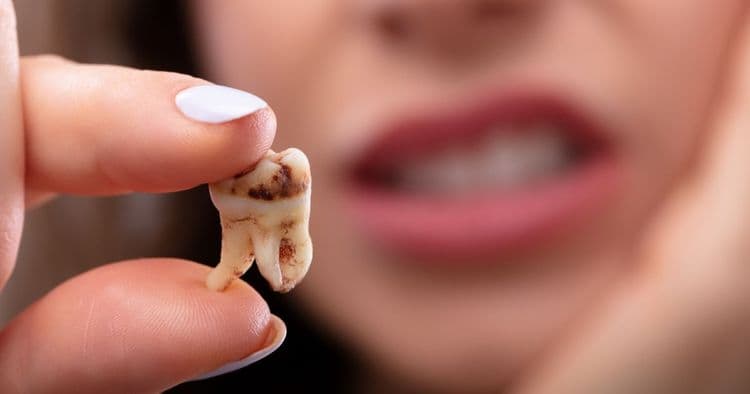 7 Natural Remedies to Prevent Tooth Decay: Keep Your Smile Healthy and Strong