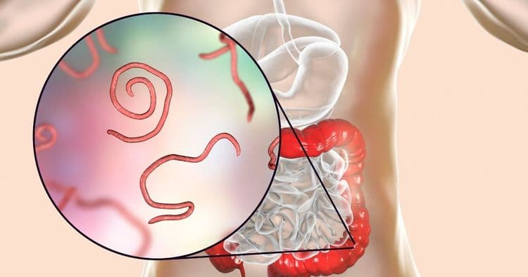6 Powerful Natural Remedies to Eliminate Parasites and Restore Your Health