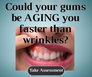 Could your gums be AGING you faster than wrinkles?